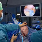 Intervención quirúrgica para mejorar un manguito rotador roto.